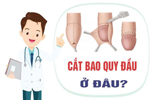 Địa chỉ cắt bao quy đầu an toàn ở hà nội